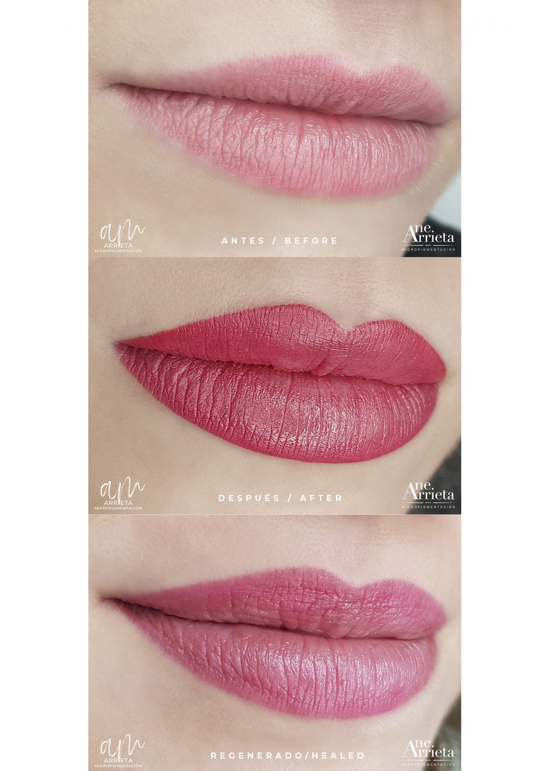 Micropigmentación de labios