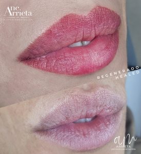 Micropigmentación de labios