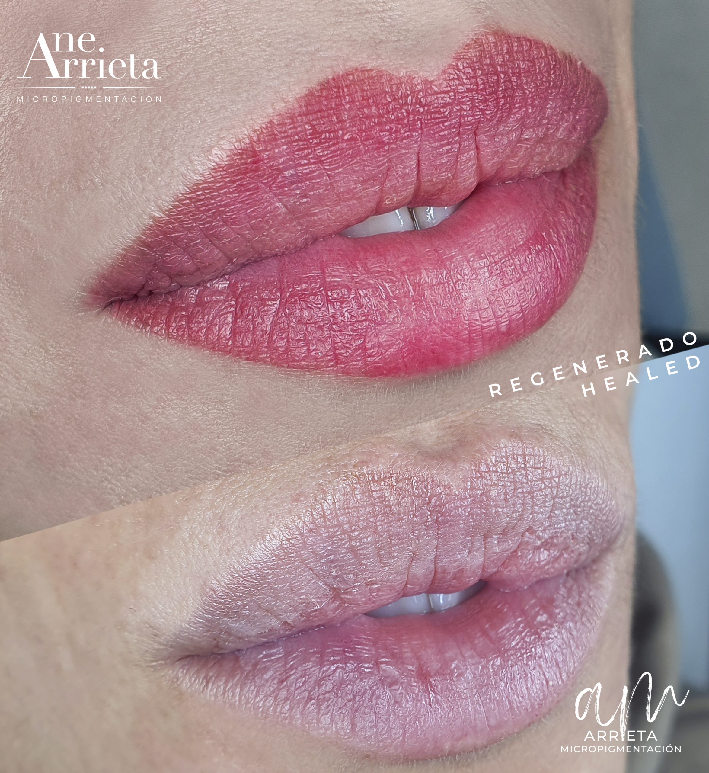 Micropigmentación de labios