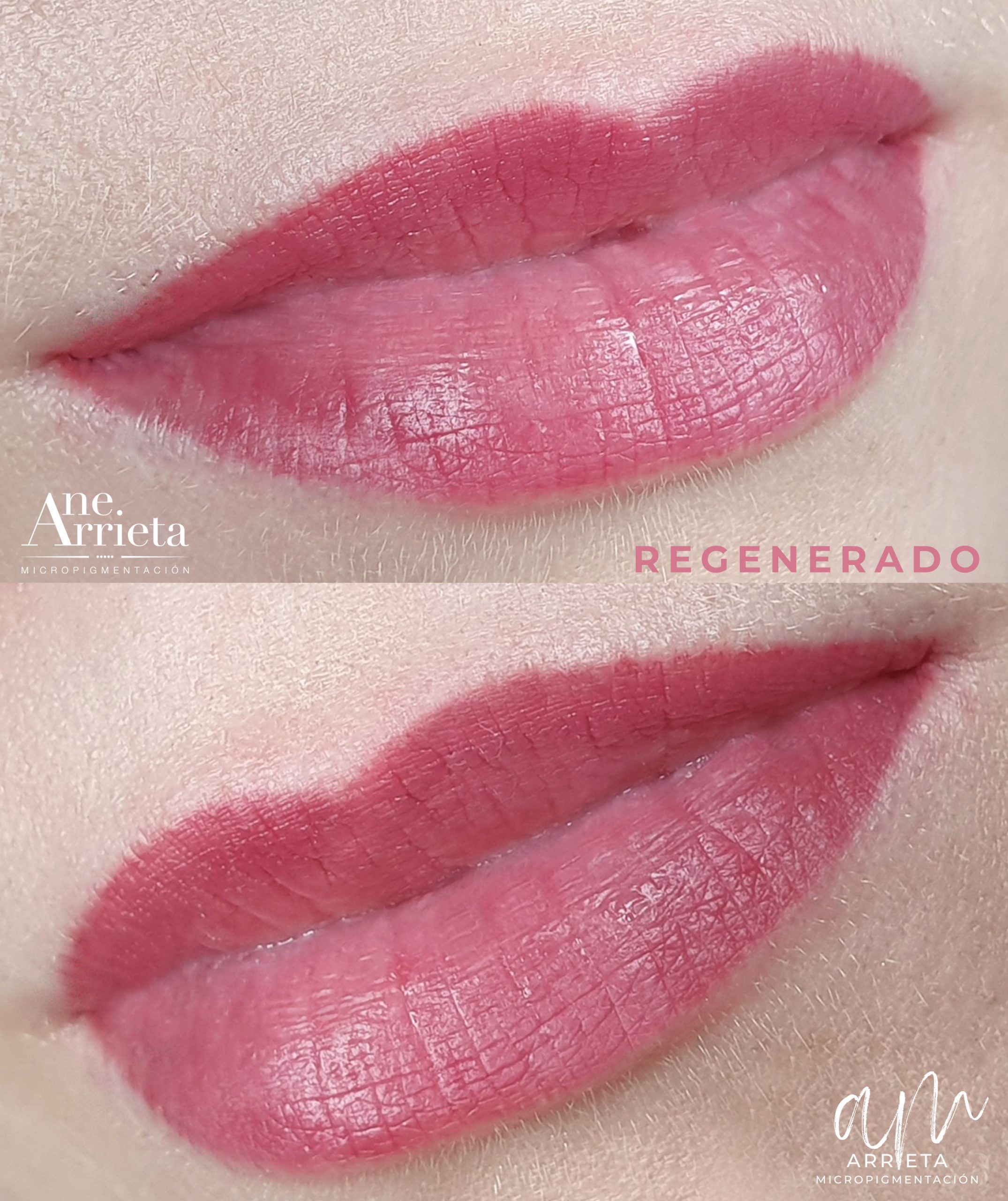 Micropigmentación de labios